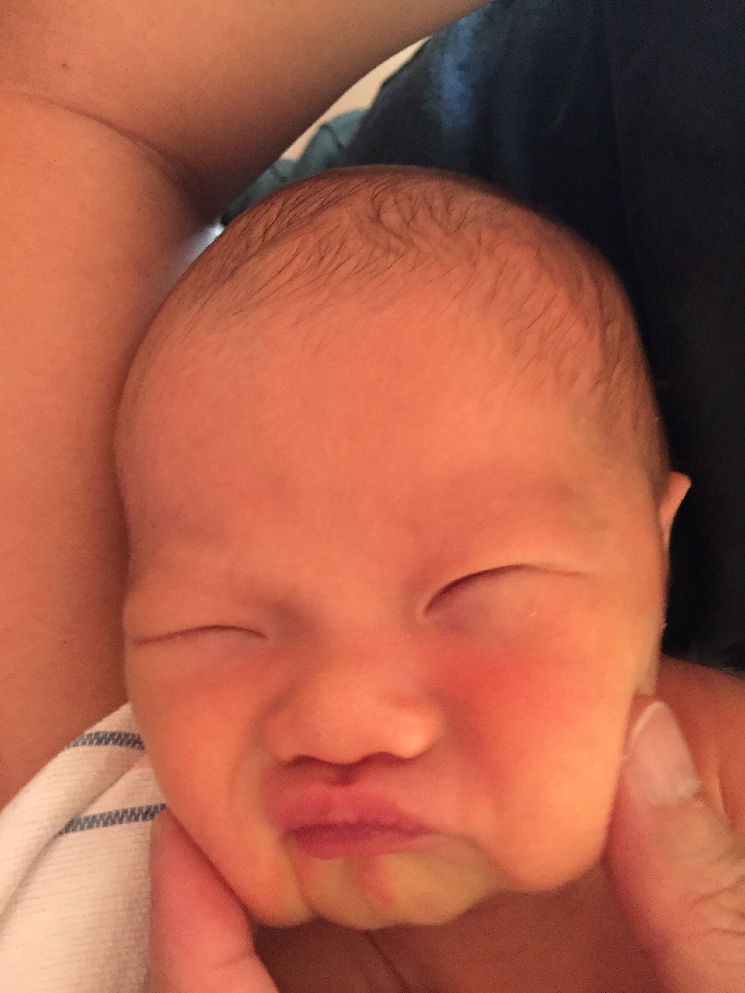 Dem Cheeks!
